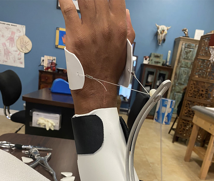 Hand Therapy Associates clinic gallery image 1