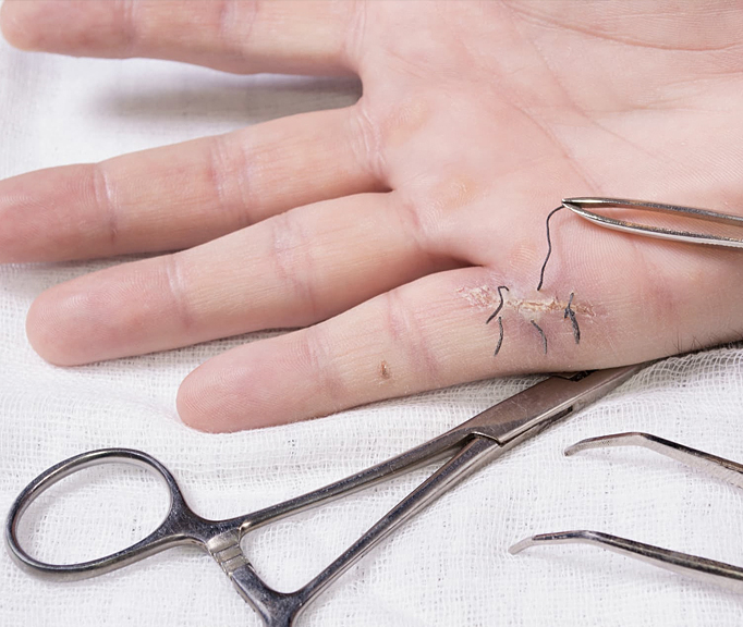 Hand Therapy Associates clinic gallery image 11