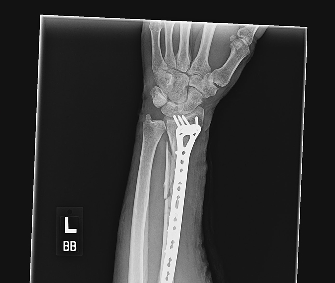 Hand Therapy Associates clinic gallery image 12