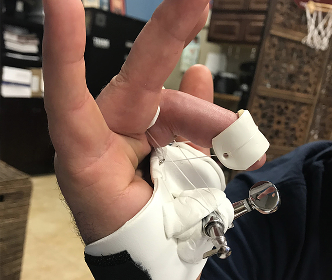 Hand Therapy Associates clinic gallery image 2