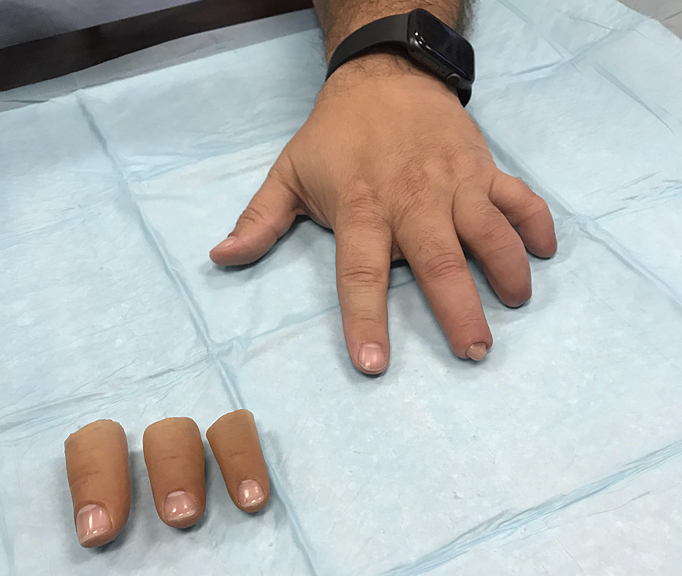 Hand Therapy Associates clinic gallery image 4