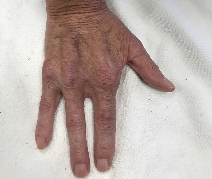 Hand Therapy Associates clinic gallery image 5