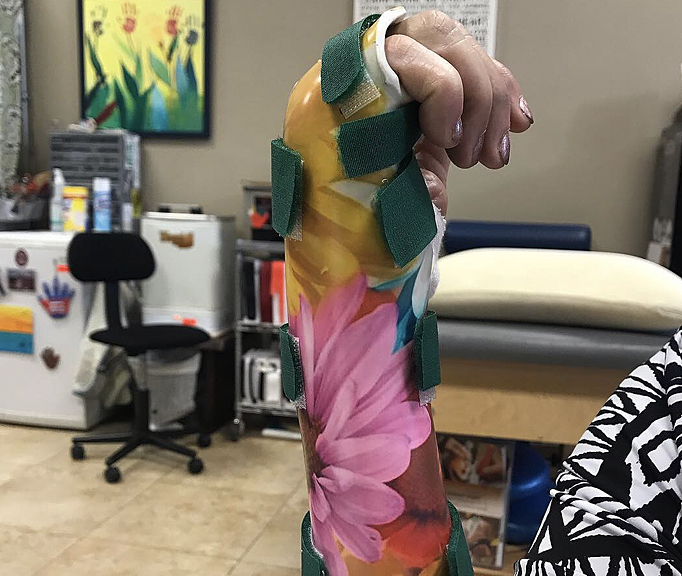 Hand Therapy Associates clinic gallery image 8